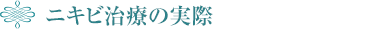 ニキビ治療の実際