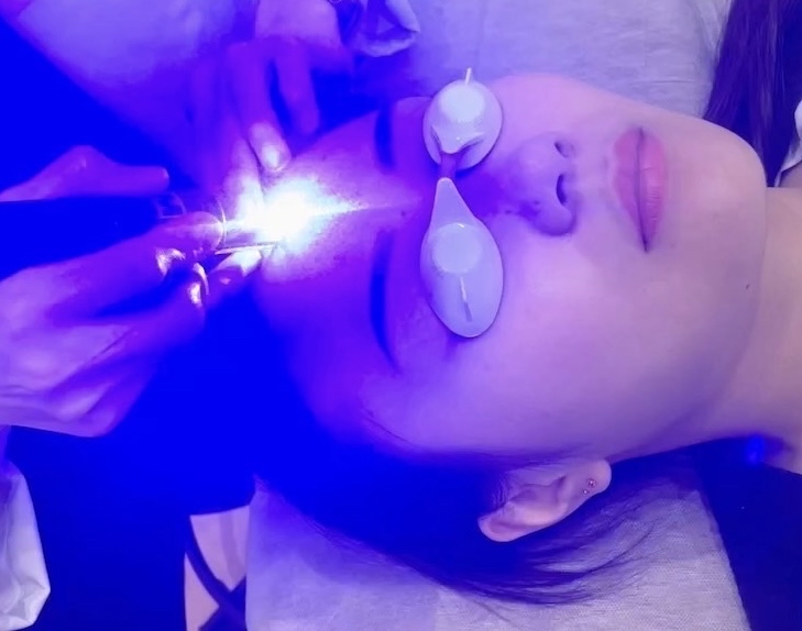 ニキビ特集画像